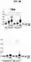Fig. 08 - IMMUNOGENIC COMPOSITION COMPRISING STAPHYLOCOCCAL ANTIGENS