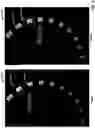 Fig. 06 - DEEP LEARNING-BASED IMAGE QUALITY ENHANCEMENT OF THREE-DIMENSIONAL ANATOMY SCAN IMAGES