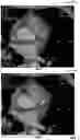 Fig. 08 - DEEP LEARNING-BASED IMAGE QUALITY ENHANCEMENT OF THREE-DIMENSIONAL ANATOMY SCAN IMAGES
