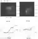 Fig. 07 - METHODS AND APPARATUSES FOR DELIVERING TUMOR TREATING FIELDS TO A SUBJECT'S BODY FOR NEAR-SURFACE TUMORS
