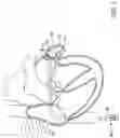 Fig. 02 - LEFT ATRIAL APPENDAGE CLOSURE DEVICE WITH ANTI-THROMBOGENIC COVERING