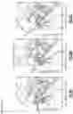 Fig. 09 - Motorcycle engine with an always spring biased open exhaust valve