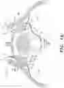 Fig. 02 - Systems for Sacroiliac Joint Stabilization