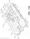 Fig. 44 - Systems for Sacroiliac Joint Stabilization