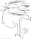 Fig. 06 - MANUAL SUCTION DEVICE FOR THROMBUS CAPTURE AND REPERFUSION