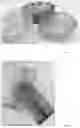 Fig. 06 - Method for fermenting biomass and producing material sheets and suspensions thereof