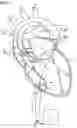 Fig. 02 - INTRAVASCULAR BLOOD PUMP