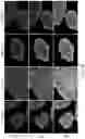 Fig. 06 - ENGINEERED CELLS FOR THERAPY
