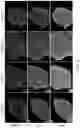 Fig. 07 - ENGINEERED CELLS FOR THERAPY