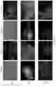 Fig. 09 - ENGINEERED CELLS FOR THERAPY