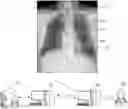 Fig. 01 - Method and system for determining abnormality in medical device