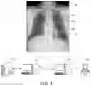 Fig. 02 - Method and system for determining abnormality in medical device