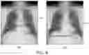 Fig. 09 - Method and system for determining abnormality in medical device