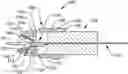 Fig. 01 - ENDOSCOPIC CLIP WITH POSITIVE LOCK