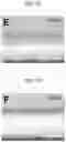 Fig. 06 - Method for fabricating oleophilic-hydrophobic nanofiber membrane and separation of water-in-oil emulsion using same method and waste heat