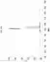 Fig. 43 - Abaloparatide formulations and methods of testing, storing, modifying, and using same