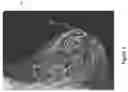 Fig. 04 - System and method for generating a 2D image using mammography and/or tomosynthesis image data