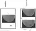 Fig. 06 - System and method for generating a 2D image using mammography and/or tomosynthesis image data