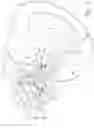 Fig. 04 - Tire engaging parking brake