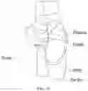 Fig. 04 - Kit for enhancing a pointe shoe including a pointe shoe cover with sensors for activating a light when standing en pointe
