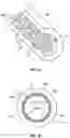 Fig. 02 - Bioartificial pancreas