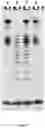 Fig. 08 - METHOD OF ISOLATION OF HYALURONAN