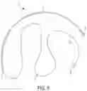 Fig. 07 - MEDICAL SYSTEMS, DEVICES AND METHODS ADAPTED FOR TISSUE FIXATION AND APPROXIMATING TISSUE DEFECTS