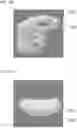 Fig. 10 - BONE GRAFT COMPOSITION