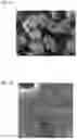 Fig. 11 - BONE GRAFT COMPOSITION