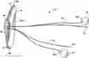 Fig. 01 - VASCULAR HOLE CLOSURE DEVICE