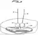 Fig. 06 - VASCULAR HOLE CLOSURE DEVICE