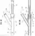 Fig. 07 - ENDOVASCULAR DELIVERY APPARATUS HAVING VARIABLE LENGTH BALLOON