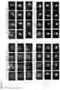 Fig. 06 - COMPOSITIONS AND METHODS FOR TREATING OCULAR DISEASE