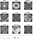 Fig. 09 - METHOD AND DEVICE WITH DEFECT DETECTION