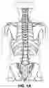 Fig. 02 - SPINE EXERCISE EQUIPMENT