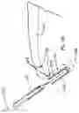 Fig. 20 - SURGICAL TOOL AND METHOD OF USE