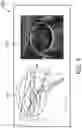 Fig. 09 - CONTEXTUAL MULTIPLANAR RECONSTRUCTION OF THREE-DIMENSIONAL ULTRASOUND IMAGING DATA AND ASSOCIATED DEVICES, SYSTEMS, AND METHODS