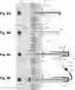 Fig. 08 - System and methods for sealing a channel in tissue