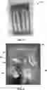 Fig. 09 - Light weight thermal runaway and explosion resistant aerospace battery