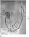 Fig. 07 - Systems And Methods Of Identifying Vessel Attributes Using Extravascular Images