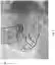 Fig. 08 - Systems And Methods Of Identifying Vessel Attributes Using Extravascular Images