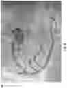 Fig. 09 - Systems And Methods Of Identifying Vessel Attributes Using Extravascular Images