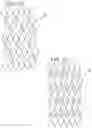 Fig. 11 - EXPANDABLE SHEATH FOR INTRODUCING AN ENDOVASCULAR DELIVERY DEVICE INTO A BODY