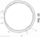 Fig. 33 - EXPANDABLE SHEATH FOR INTRODUCING AN ENDOVASCULAR DELIVERY DEVICE INTO A BODY