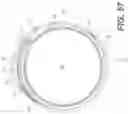 Fig. 35 - EXPANDABLE SHEATH FOR INTRODUCING AN ENDOVASCULAR DELIVERY DEVICE INTO A BODY