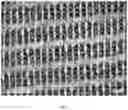 Fig. 04 - Composite laminated papermaking fabrics and methods of making the same