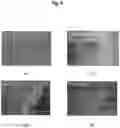Fig. 07 - METHOD FOR MANUFACTURING INDUCED PLURIPOTENT STEM CELLS