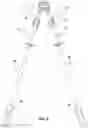 Fig. 04 - Trek Rod Engageable Support