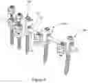 Fig. 07 - Minimally invasive surgery add on screw system