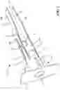 Fig. 02 - Anchor assembly
